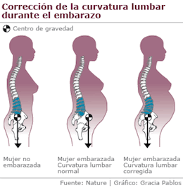 lumbares embarazo